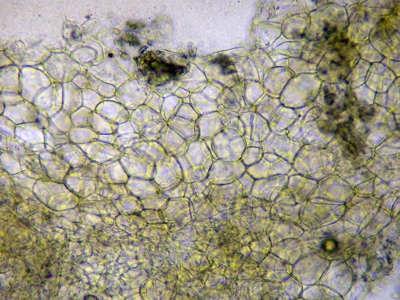 Cheilymenia theleboloides 10 - Excípulo ectal agua x 400-001